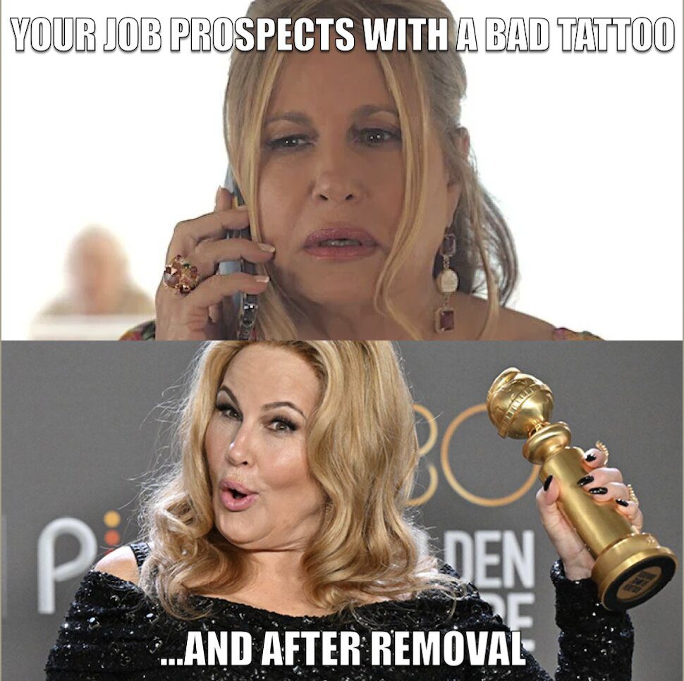 Tattoo Removal Memes