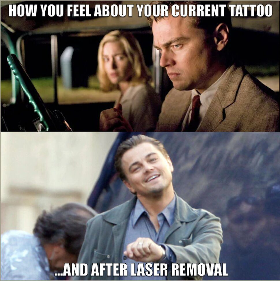Tattoo Removal Memes