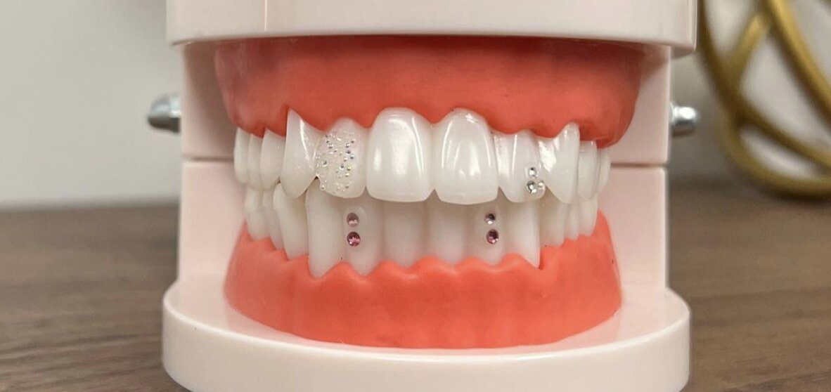 Are Tooth Gems Safe Vancouver BC